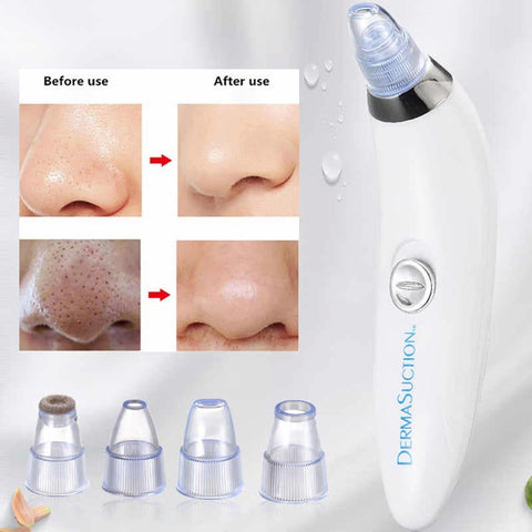 Vacuum  Derma Suction 4 in 1 Blackhead Whitehead Extractor Remover Device